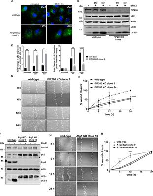 Loss of the Essential Autophagy Regulators FIP200 or Atg5 Leads to Distinct Effects on Focal Adhesion Composition and Organization